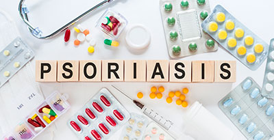 Tratamiento psoriasis